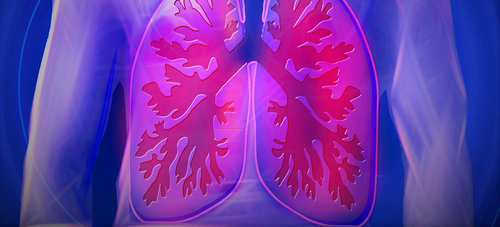 Cystic Fibrosis: A Useful Guide