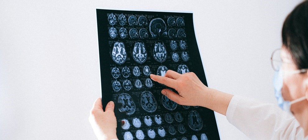 Traumatic Brain Injury in Older Adults: Support & Advice